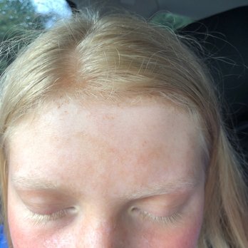 Sun Tan City - i do not have freckles. - Tanning Near Me - Hixson, Tennessee