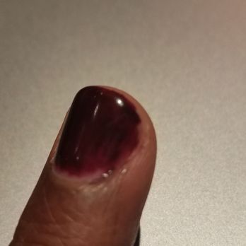 Salon Vollo - Gel manicure failure - Hair Salons Near Me - New York, New York