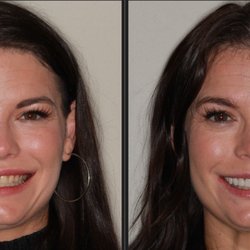 Pinnacle Dental Associates