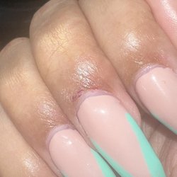 Only Nails - Bleeding at cuticle