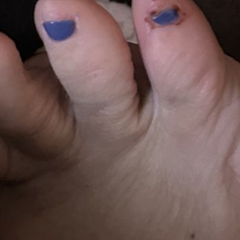Euphoria Nails & Spa - My baby toe and file marks! Ouch!! - Nail Salons Near Me - Ontario, California
