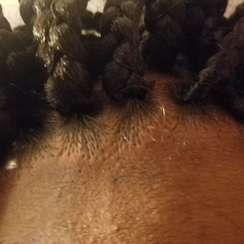 My braids are so tight I took them out as soon as I got home because it gave me a horrible headache and it was so horrible to make me cry My braids are so tight I took them out as soon as I got home because it gave me a horrible headache and it was so horrible to make me cry