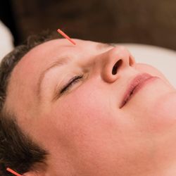 Wild Blue Acupuncture and Wellness