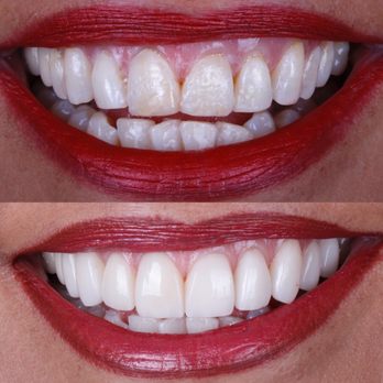 DEO Clinic - Diseño de sonrisa - Oral Surgeons Near Me - Guadalajara, JAL