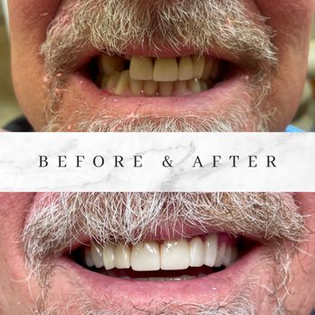 Haley Miller Dentistry - New implant, crown and bridge - General Dentistry Near Me - Madisonville, Louisiana Haley Miller Dentistry - New implant, crown and bridge - General Dentistry Near Me - Madisonville, Louisiana
