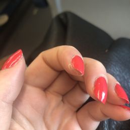 Cracked skin Cracked skin