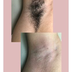 Waxtopia - Male Underarm Wax