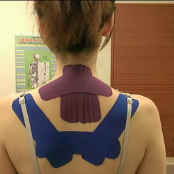 Thomas Wong Chiropractic - Kinesiology Tape can help patients with hunched back, upper back pain, and neck pain. Elderly patients can improve as well!