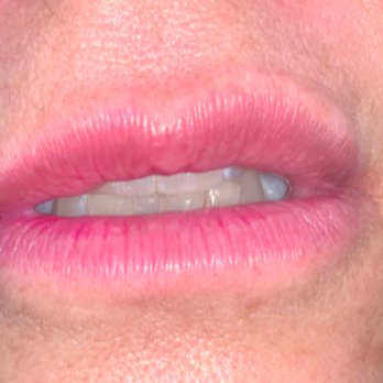 Augusta Plastic Surgery - Plastic Surgeons Near Me - Martinez, Georgia Augusta Plastic Surgery - Plastic Surgeons Near Me - Martinez, Georgia
