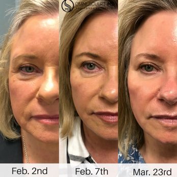 Omni Sculpt MD - Medical Spas Near Me - Dallas, Texas