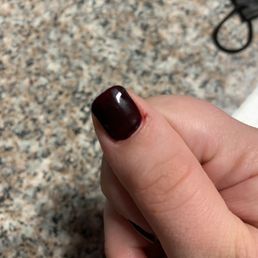 Cuts on my cuticles from careless rushed service Cuts on my cuticles from careless rushed service