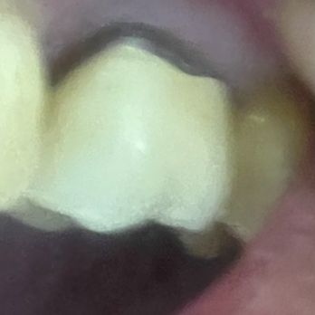 Bernard W Ang, DMD - The Hacks. - General Dentistry Near Me - Amherst, New Hampshire