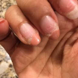 Nails started chipping off. Nails started chipping off.