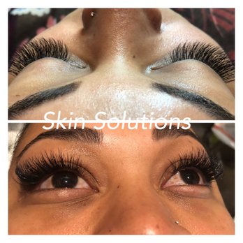 Skin Solutions - Skin Care Near Me - Corona, California Skin Solutions - Skin Care Near Me - Corona, California
