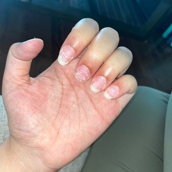 Neu Nails & Spa - Destroyed finger nails - Nail Salons Near Me - Henrico, Virginia Neu Nails & Spa - Destroyed finger nails - Nail Salons Near Me - Henrico, Virginia