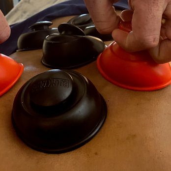 Relief by Chase - Cupping Massage Therapy - Fascial Movement Technique - Massage Therapy Near Me - Charlottesville, Virginia Relief by Chase - Cupping Massage Therapy - Fascial Movement Technique - Massage Therapy Near Me - Charlottesville, Virginia