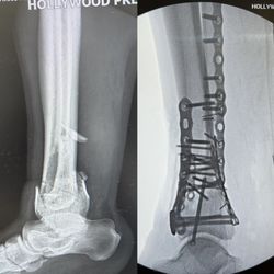Aziz Rasooli, DPM- Memorial Orthopaedic Surgical Group