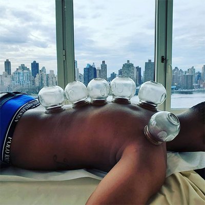 Cupping - Schedule your appointment today! Cupping - Schedule your appointment today!