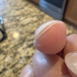 Lifting nails after 3 days Lifting nails after 3 days