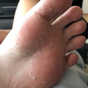 Comfort Nails - Photo is self explanatory. Rushed and poorly done. - Nail Salons Near Me - Toronto, Ontario