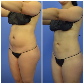 Amaryllis Pascual, MD - Cosmetic Surgeons Near Me