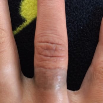 Rosestone Jewelry - Staining from my "silver" custom Burning Man ring. - Jewelry Near Me - San Diego, California Rosestone Jewelry - Staining from my "silver" custom Burning Man ring. - Jewelry Near Me - San Diego, California