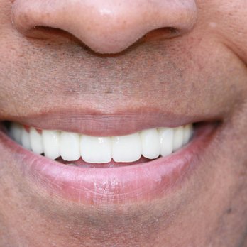 Dental Illusions: Basil Moukarim, DDS - "Smile With Confidence" - General Dentistry Near Me - Houston, Texas