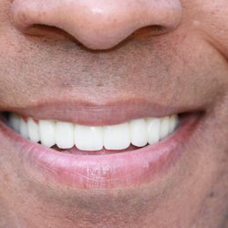 "Smile With Confidence"