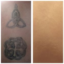 Sonic Tattoo