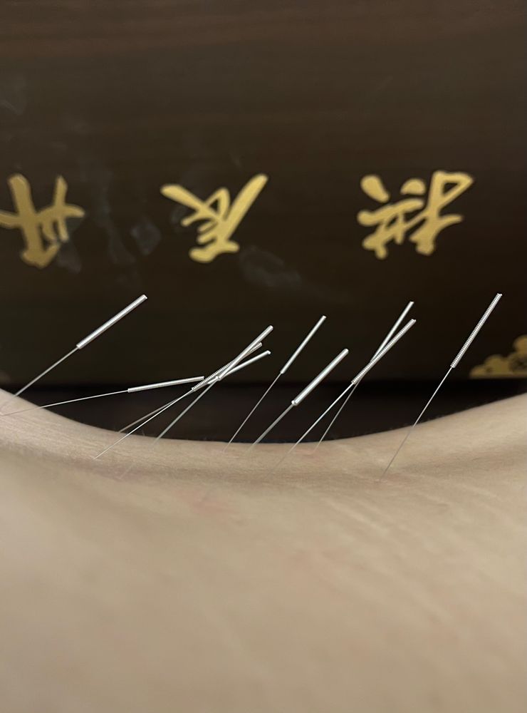 HAN ACUPUNCTURE HEALTH CENTER Updated September 2024 15 Photos