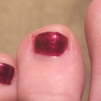 Elite Nails - One of my toes where she didn't cover the entire nail with the second coat of polish. She also left polish on my skin. - Nail Salons Near Me - Vista, California Elite Nails - One of my toes where she didn't cover the entire nail with the second coat of polish. She also left polish on my skin. - Nail Salons Near Me - Vista, California