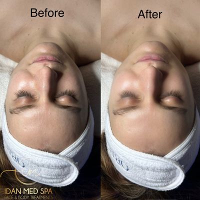 Idan Med Spa by null