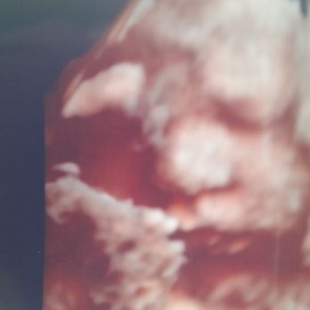 Kicks and Giggles - Tongue out hahaha - Ultrasound Imaging Centers Near Me - Provo, Utah