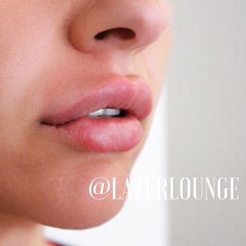 Lazer Lounge - Laser Hair Removal Near Me - Studio City, California Lazer Lounge - Laser Hair Removal Near Me - Studio City, California