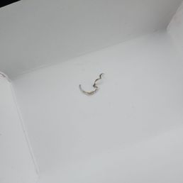 Strip of foil/metal found in filling Strip of foil/metal found in filling