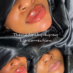 The Medspa By Rayray