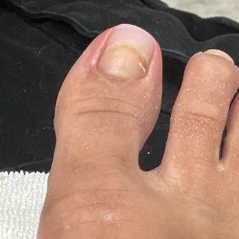 Mystic Nails - Acrylic toe nail fix - Nail Salons Near Me - Benicia, California Mystic Nails - Acrylic toe nail fix - Nail Salons Near Me - Benicia, California