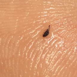 Bed bugs found on my body and in my belongings after leaving hotel Bed bugs found on my body and in my belongings after leaving hotel