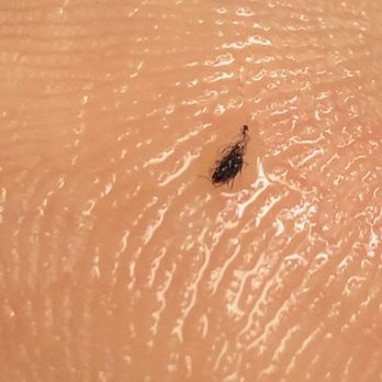 The Hotel Newton - Bed bugs found on my body and in my belongings after leaving hotel - Hotels Near Me - New York, New York The Hotel Newton - Bed bugs found on my body and in my belongings after leaving hotel - Hotels Near Me - New York, New York