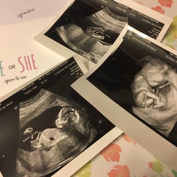 First Look Ultrasound - Our gender reveal envelope at 16 weeks. - Diagnostic Imaging Near Me - Kaneohe, Hawaii