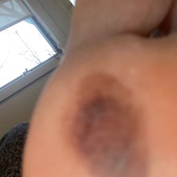 Bottom of my foot from a pedicure 17 days ago at Paint Nail Bar, Solon, Ohio