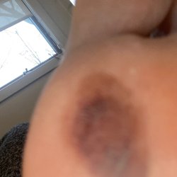 Paint Nail Bar - Bottom of my foot from a pedicure 17 days ago at Paint Nail Bar, Solon, Ohio