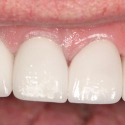 O2 Dental Group of Fayetteville