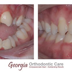 Georgia Orthodontic Care