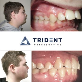 Trident Orthodontics - Orthodontists Near Me - Eastvale, California
