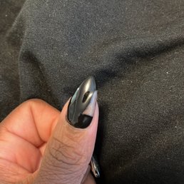 Went to sleep and woke up, my thumbs had peeled off. Went to sleep and woke up, my thumbs had peeled off.