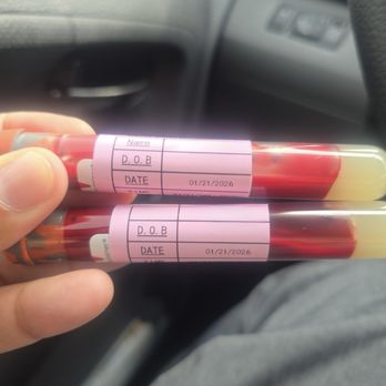 Gentle Butterfly Phlebotomy Services - (I erased our info from label to protect my son's info) - Laboratory Testing Near Me - Anaheim, California Gentle Butterfly Phlebotomy Services - (I erased our info from label to protect my son's info) - Laboratory Testing Near Me - Anaheim, California