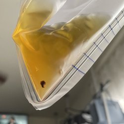 Dr. Mohamed Akl - This is what my UroGyn couldn't trouble themselves to follow up on. (Blood clot)