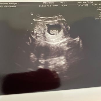 Baby Sightings - Baby's first selfie. - Diagnostic Imaging Near Me - Bakersfield, California