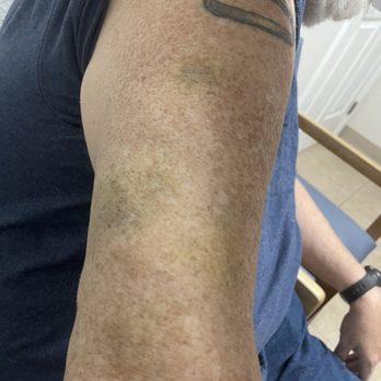 Gulf Coast Medical Center - They took care of my bruise!! - Medical Centers Near Me - Spring Hill, Florida